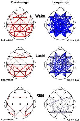 Frontiers | Insight And Dissociation In Lucid Dreaming And Psychosis